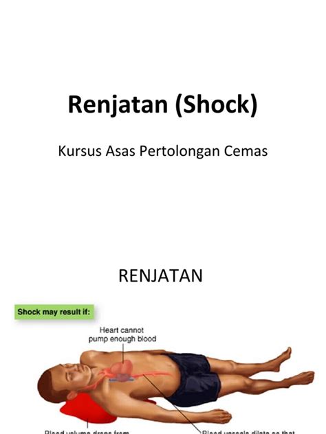 renjatan shock