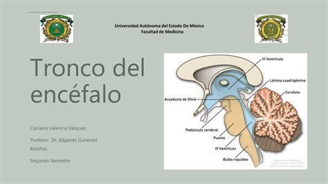 Exposici N Tronco Del Enc Falo Caty Maviel Cardoso Popoca Udocz