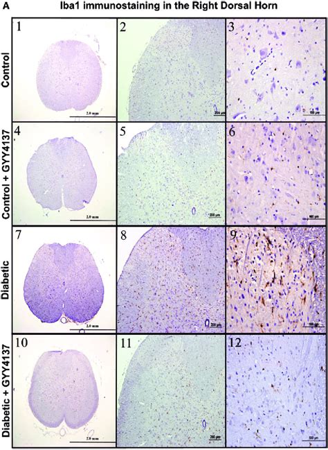 A Photographs Showing The Iba Immunoreactive Microglia Cells Of The