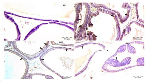 Photomicrograph Depicting Immunohistochemistry IHC Staining Of COX 2