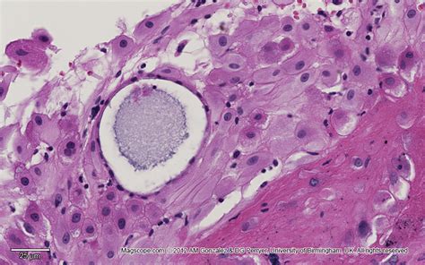 Placenta Histology Labeled