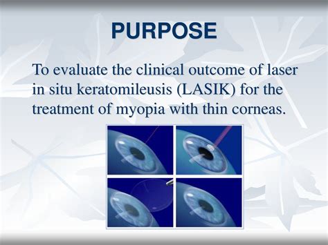 Clinical Outcome Of Thin Corneas After Laser In Situ Keratomileusis