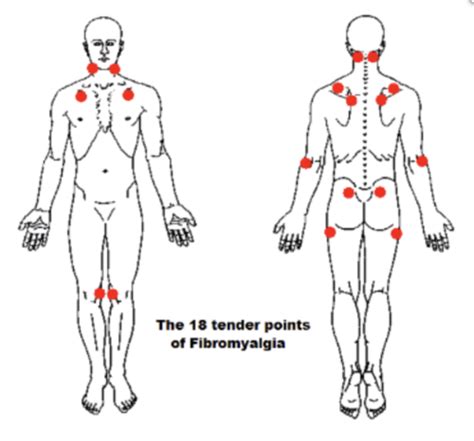 Orthopedics Rheumatology Flashcards Quizlet