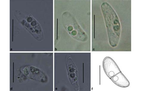 Light Micrographs Of Ceratomyxa Siganicola N Sp A C Mature Spores D