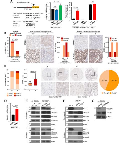 Figure 3 From Suppression Of ACADM Mediated Fatty Acid Oxidation