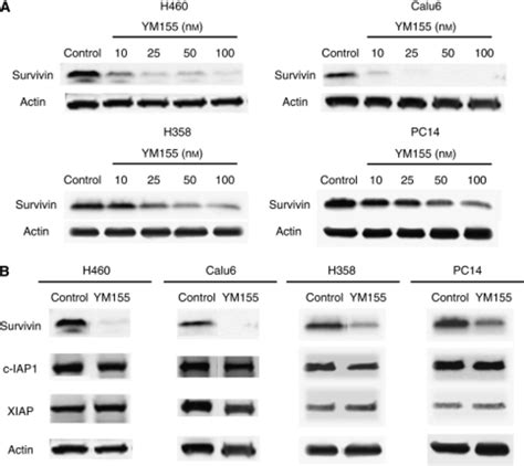 Effect Of Ym155 On Survivin Expression In Human Non Small Cell Lung