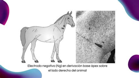 Estudio De Caso Cl Nico Electrocardiograma Pptx