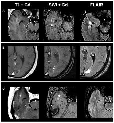 Frontiers Characterization Of Contrast Enhancing And Non Contrast