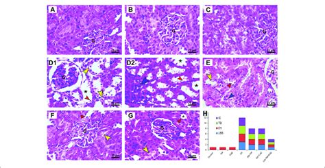 Histopathology Of Kidney Tissue In Control And Cd Tm And