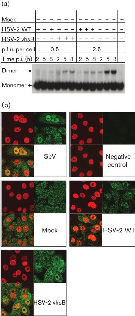 Irf Activation In Vk Cells Infected With Hsv Vhsb A Vk Cells