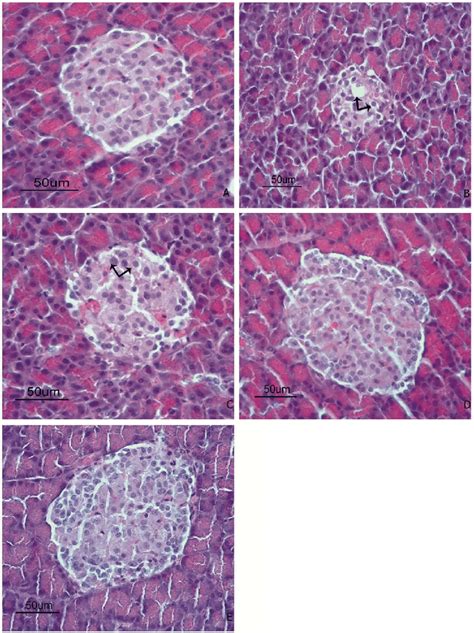 H And E Stained Sections Of Pancreas Bar 50 µm A Normal Appearance Download Scientific