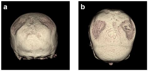 Diagnostics Free Full Text Long Term Comparison Of Two And Three