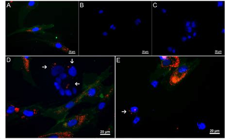 Fluorescence Imaging Of Quantum Dot Qd Intracellular Accumulation In Download Scientific