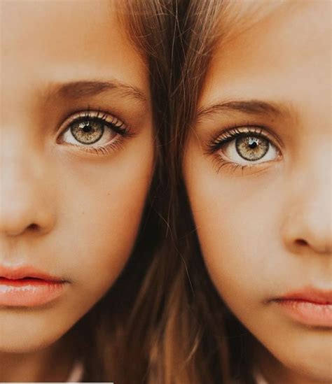 People Say 7 Year Old Sisters Are The Most Beautiful Twins In The World Now Theyre