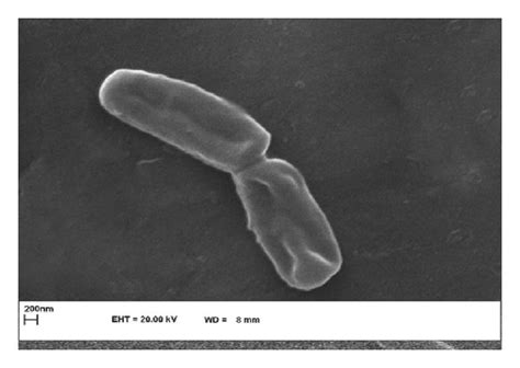 Scanning Electron Microscopy Images Of Untreated E Coli Cells A