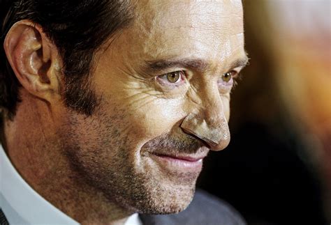 Hugh Jackman Habla Sin Tapujos Sobre Su Cáncer De Piel Todo Está Bien