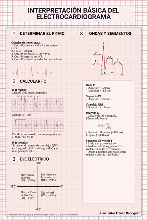 Interpretación básica del electrocardiograma Escuela Ciencias de la Salud