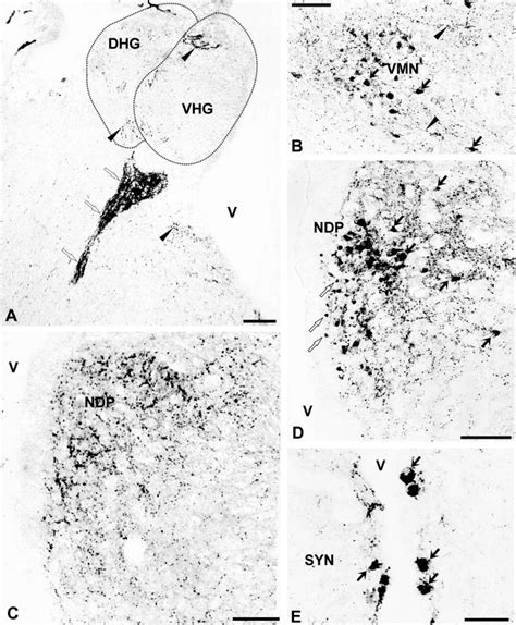 Transverse sections through the optic tectum and midbrain tegmentum ...