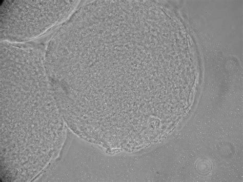 Mature Oocytes