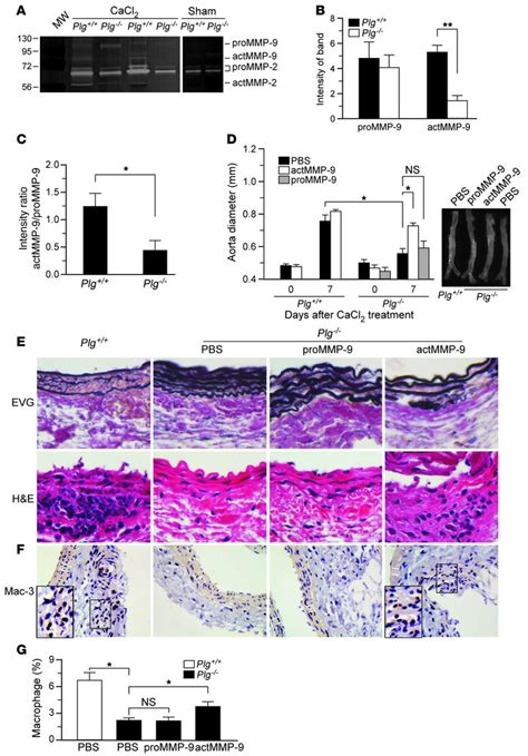 Jci Inflammatory Macrophage Migration Requires Mmp 9 Activation By