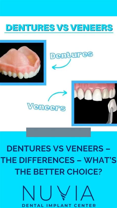 Dentures Vs Veneers The Differences Whats The Better Choice And A