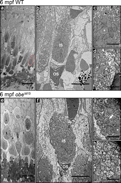 Altered Mitochondrial Morphology In The Obetd15 Cone Photoreceptors Download Scientific