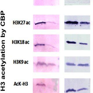 A Model For CBP And HDAC Regulation Of Acetylation And JH Action