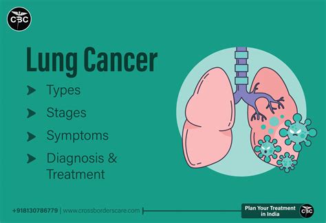 Lung Cancer Types Symptoms Diagnosis And Treatment Crossborders Care