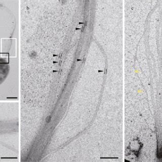 Flagella characteristics of QR-1 a. overall TEM image showing... | Download Scientific Diagram