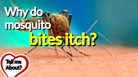 Why Do Mosquito Bites Itch Tell Me About Youtube