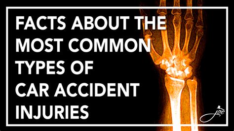 Facts About the Most Common Types of Car Accident Injuries.