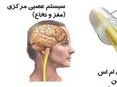 آیا بیماری ام اس قابل درمان است