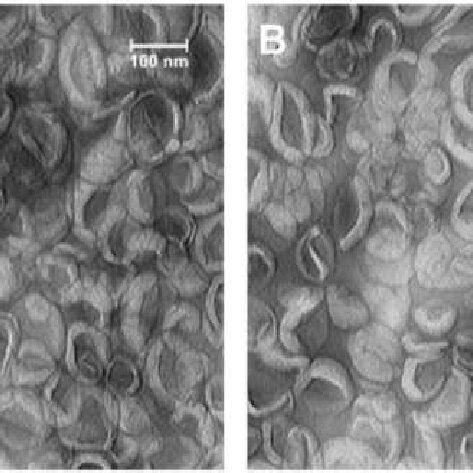 Transmission Electron Microscopy Tem Images Of Negatively Stained