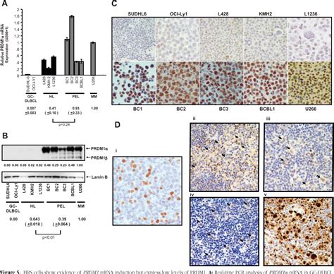 Figure From Tumorigenesis And Neoplastic Progression Microrna