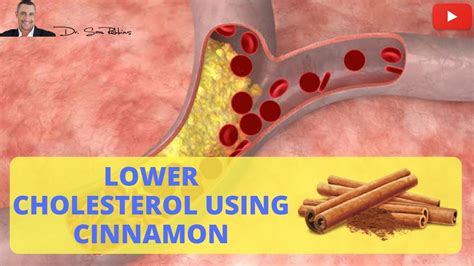 💓 A Clinically Proven Way To Lower Cholesterol Using Cinnamon By Dr Sam Robbins Youtube