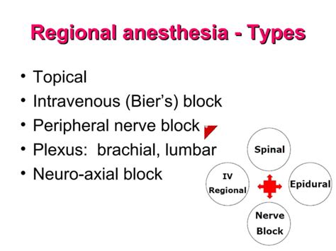 Regional Anesthesia | PPT