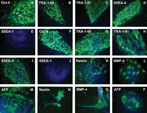 Immunofluorescence Staining For Markers Characterizing Undifferentiated Download Scientific