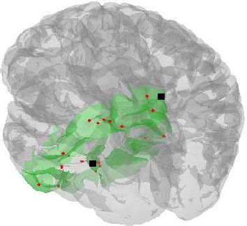 Figure From Transfer Function Based Calibration Of Sparse Eeg Systems