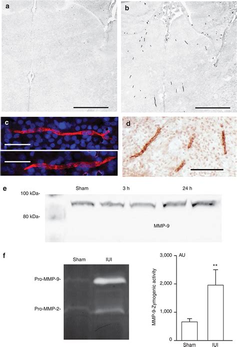 Matrix Metalloproteinase Induced By Prenatal Ischemia Immunolabeling