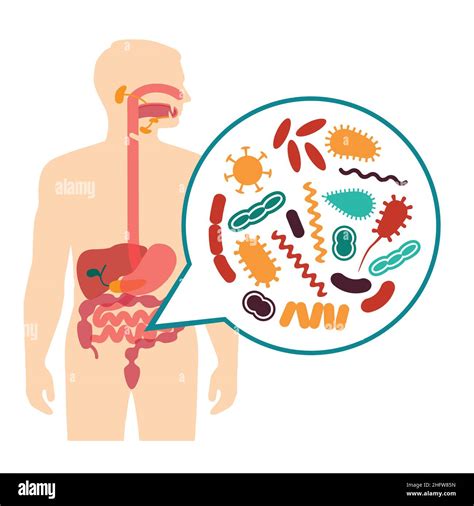 illustration vectorielle médicale de maux d estomac problèmes du