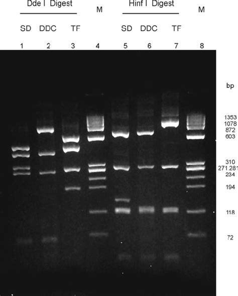 Ethidium Bromidestained Agarose Gel Electrophoresis Analysis Of Cdna