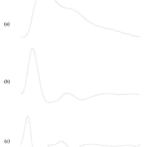 A typical waveform of the PPG and its characteristic... | Download ...