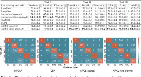 Anatomy Aware Contrastive Representation Learning For Fetal Ultrasound Paper And Code Catalyzex