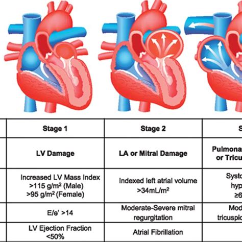 Aortic Stenosis Stages