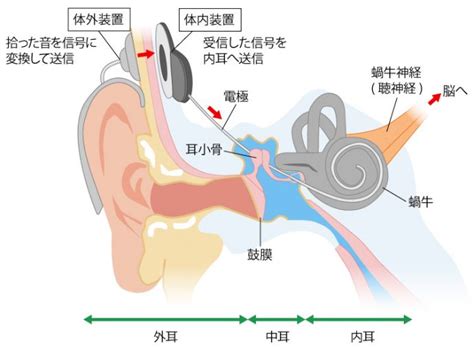 先天性難聴 (せんてんせいなんちょう)とは | 済生会
