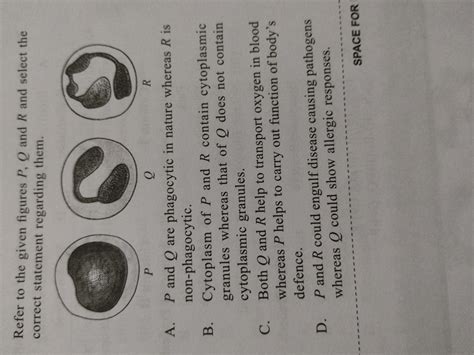 Refer To The Given Figures P Q And R And Select The Correct Statement