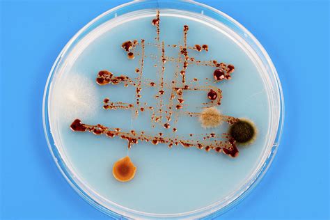 Petri Dish With Bacteria Photograph By Wladimir Bulgarscience Photo