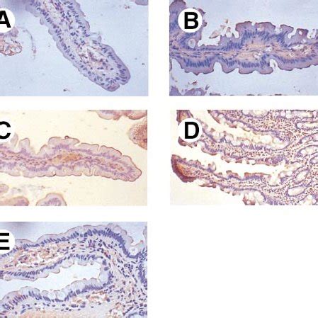 Dmt Protein Expression In Duodenal Biopsy Specimen Western Blot