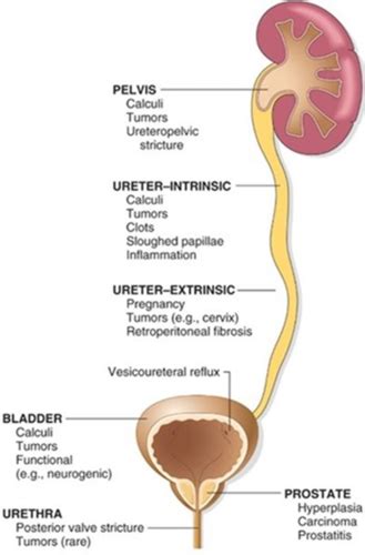 NEPHRO PATHO Flashcards Quizlet