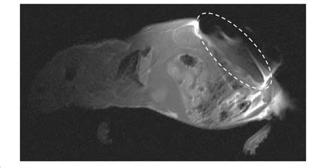 4 Implant Imaging By MRI MRI Imaging Of A Swiss Nude Mouse Bearing A